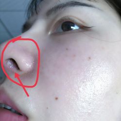 体验后-厦门美莱整形美容医院