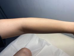 -植蔻妍倍儿专业脱毛·皮肤管理