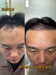 -雍禾植发全国连锁