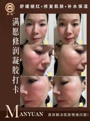 -黎蓓露·徒手骨雕蛋白抗衰·调肤管理