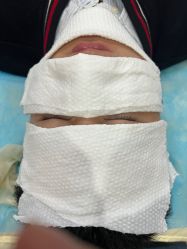 体验后-素美医疗美容·西南眼鼻整形·修复基地