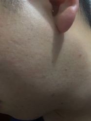 -蕾特恩专业祛痘·皮肤管理