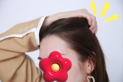 -大麦微针植发丨全国连锁