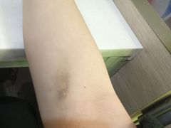 -广州仁爱天河医院体检中心