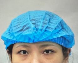 -天津健丽·去眼袋医疗美容机构