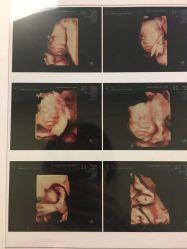 -杭州贝瑞斯美华妇儿医院·早孕·产检·儿科