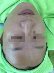 -苗医生草本科技祛痘