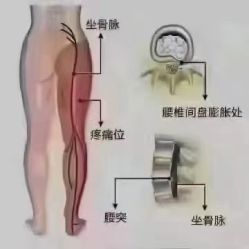 -香薇妮丝女子减肥院