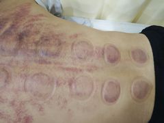 -手功夫·月明中医诊所·正骨推拿艾灸