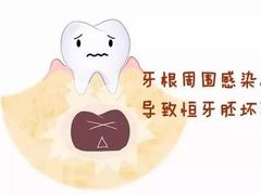 -团圆口腔·种植中心(锦江院区)