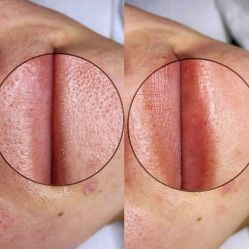 -美肤盾祛痘·问题肌头疗管理中心