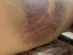 -辽宁省人民医院