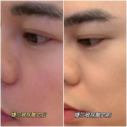 -南宁华美医疗美容医院