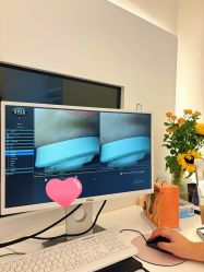 -苑苑vbeauty科技美容SPA