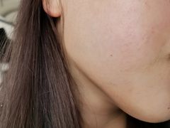 -中国医学科学院皮肤病医院