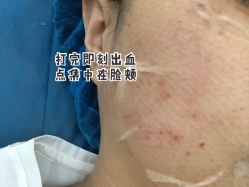 -贵阳美莱医疗美容整形医院