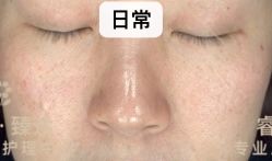 点击看大图 -睿明真达专业皮肤护理中心