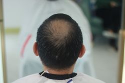 -发饰美男士增发补发假发定制店