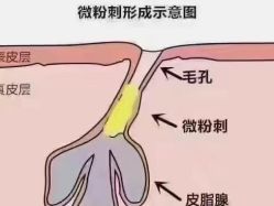 -蕾特恩专业祛痘·皮肤管理