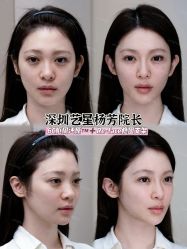 -深圳艺星医疗美容医院