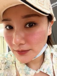 体验后-瑞鑫创美·高定轻医美