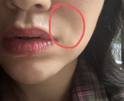 体验后-杭州奥拉克医疗美容门诊部