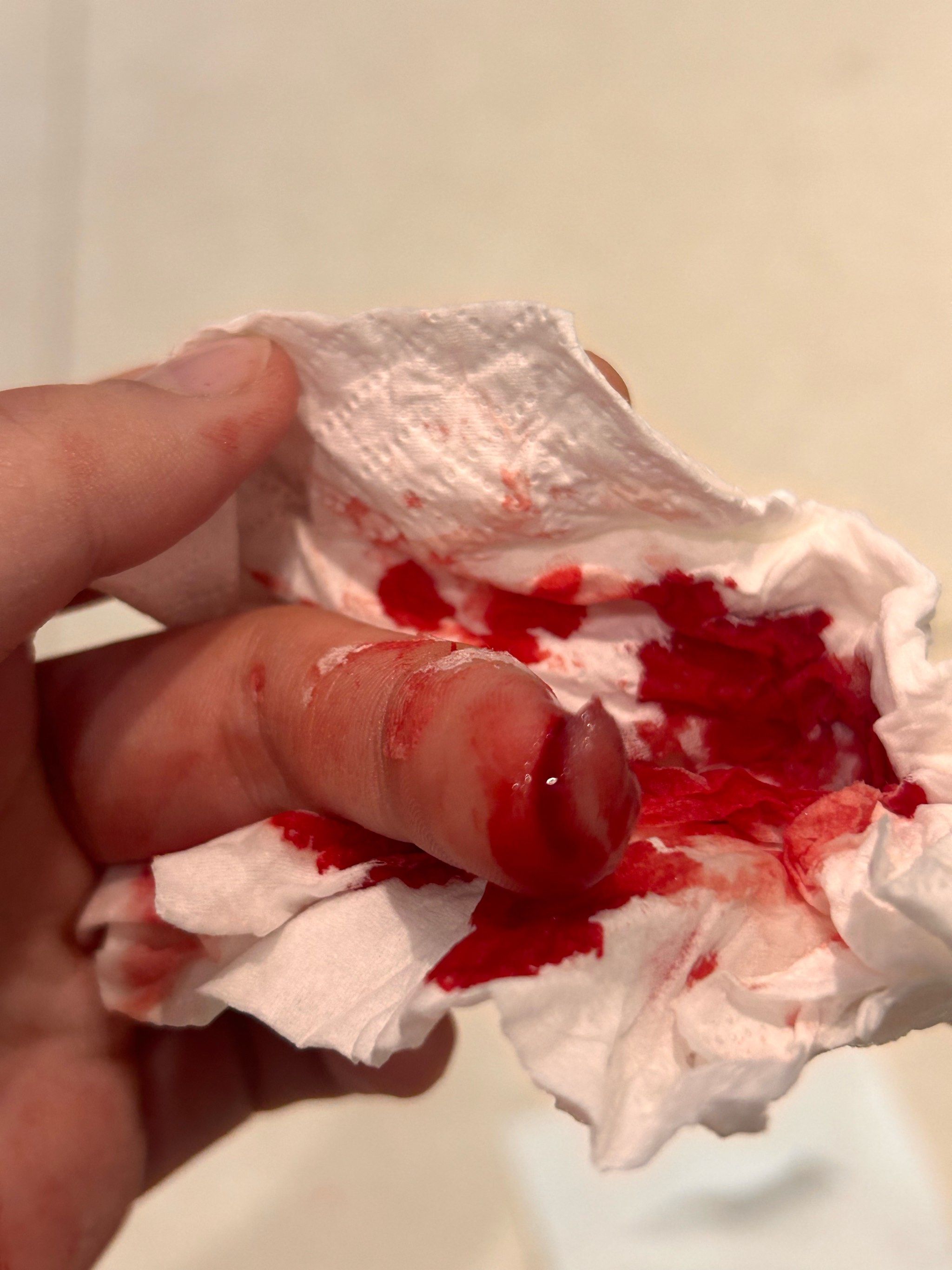 到痛,感觉到切肉的时候已经开始冒血,然后当时拿纸包住,一直在流血