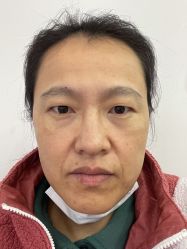 体验前-联合丽格·张菡丽格医疗美容