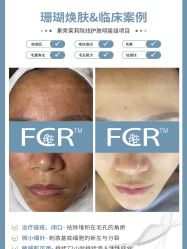 -苗方清颜痘肌研究所