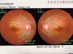-美尔目眼科医院·近视手术·儿童近视(通州店)