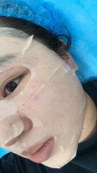 -agge蛋白医美