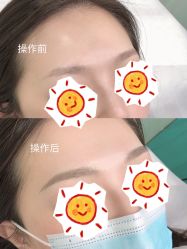 -久匠半永久纹眉