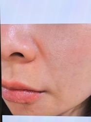 -Yestar 嘉兴艺星医疗美容医院