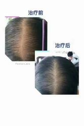 -博士园养发馆