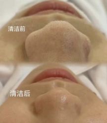 -SKIN79皮肤管理中心