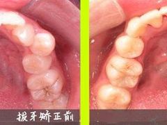 -团圆口腔·种植中心(锦江院区)