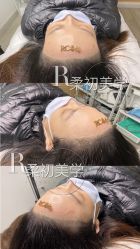 -RC半永久纹眉纹发际线