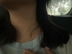 体验后-重庆军科整形美容医院