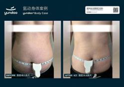 点击看大图 -栖SPA·ONDA ·海菲秀·皑皑科技美肤中心