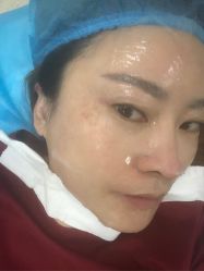 -成都西区医院整形美容