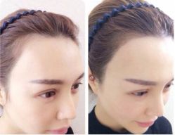 点击看大图 -弘美医美·艾维岚童颜抗衰中心