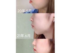 -极光口腔·矫正种植修复(锦江店)