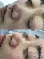 -蕾特恩专业祛痘·皮肤管理
