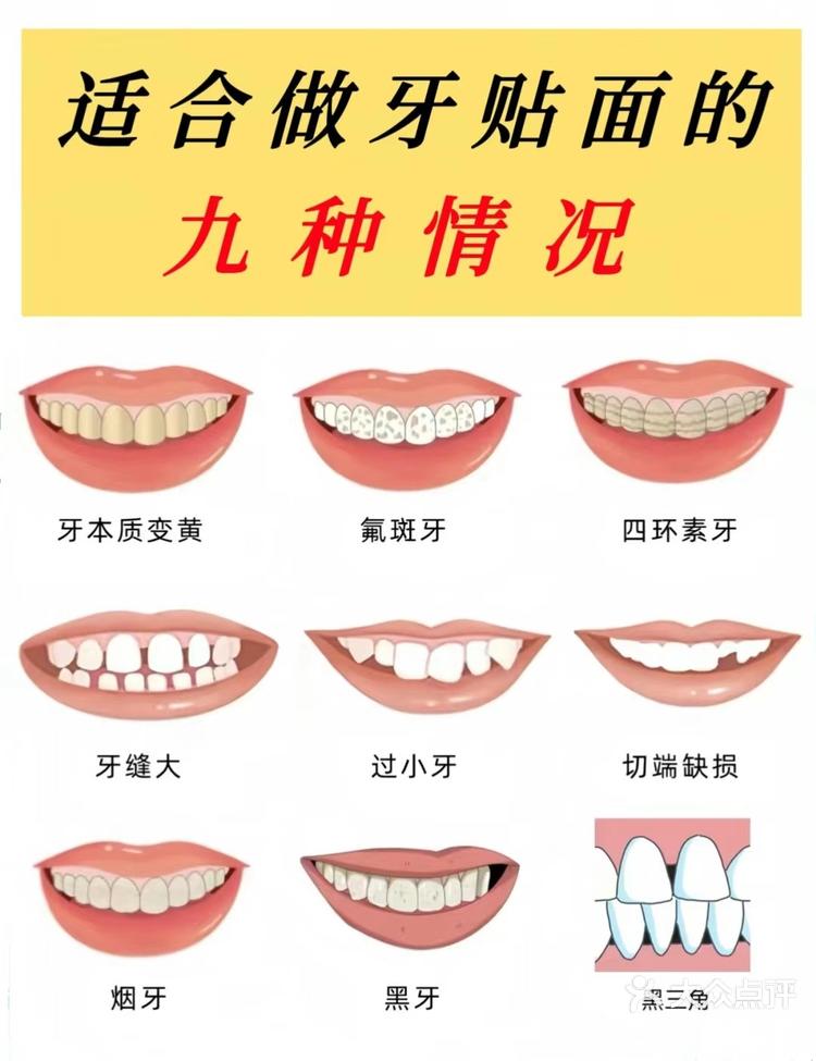 牙龈大怎么办图片