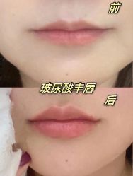 -上海漾颜医疗美容