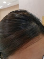 -熙朵美学植发·连锁品牌