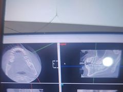 -土豆口腔(凤凰北总店)