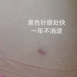 体验后-JUVA郑州欧华医疗美容医院