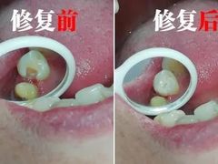 -柏乐口腔医院·舒适化无痛种植牙中心(东盟商务区院)