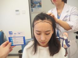 -大麦微针植发丨全国连锁